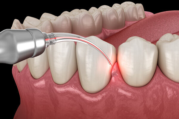 Periodontics